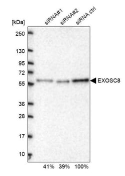 Exosome component 8 Antibody, Novus Biologicals 0.1mL; Unlabeled:Antibodies,